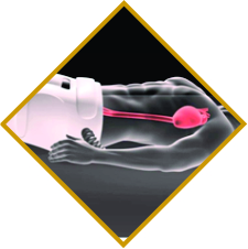 Medical device development and simulation